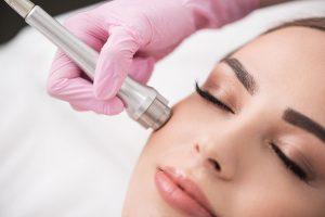 Microdermabrasion Facial